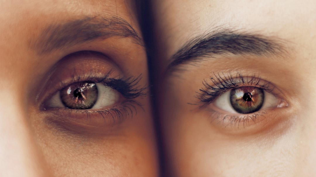 Photo Eye surgery
