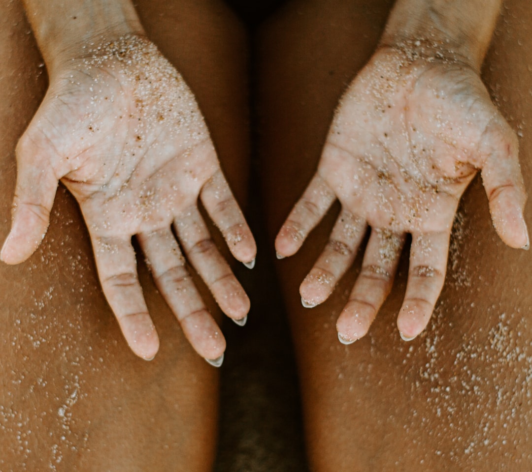 Photo Skin rash