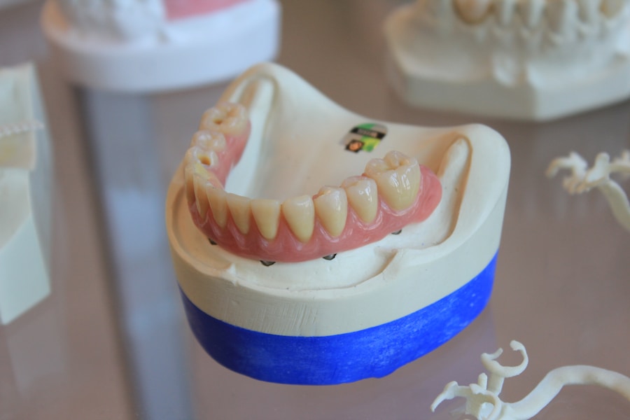 Photo Types of tooth decay