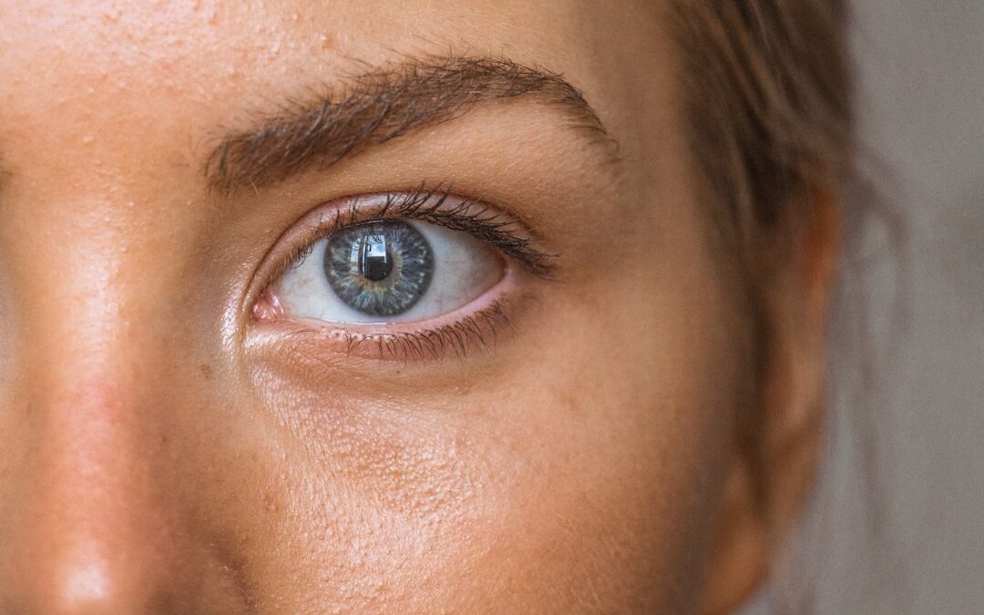 Photo Skin lesions