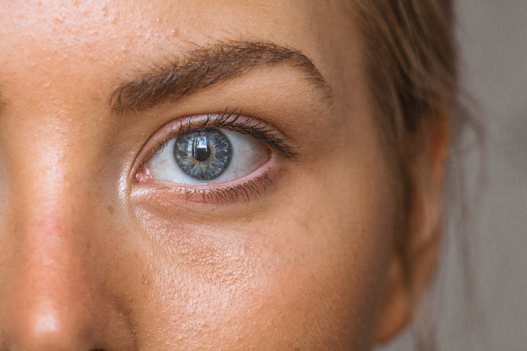 Photo Skin lesions