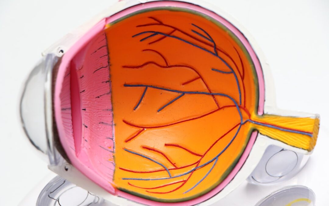 Photo Eye surgery