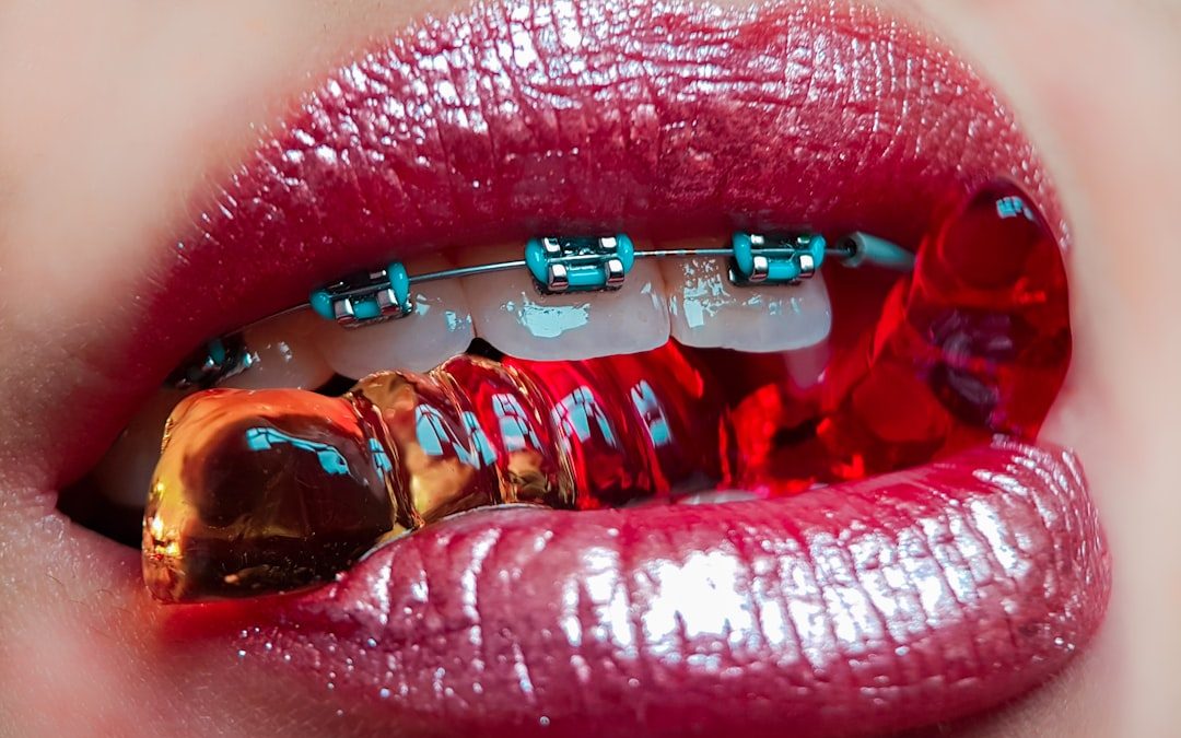 Photo Braces