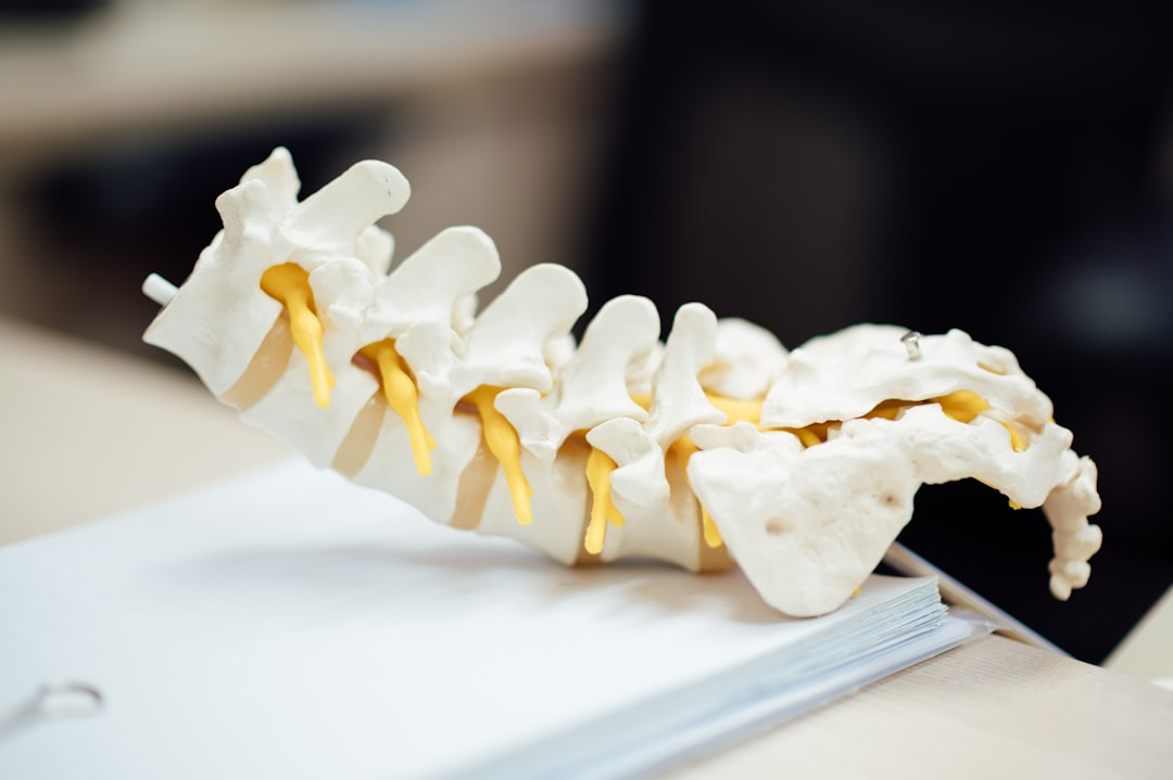 Photo Spine diagram