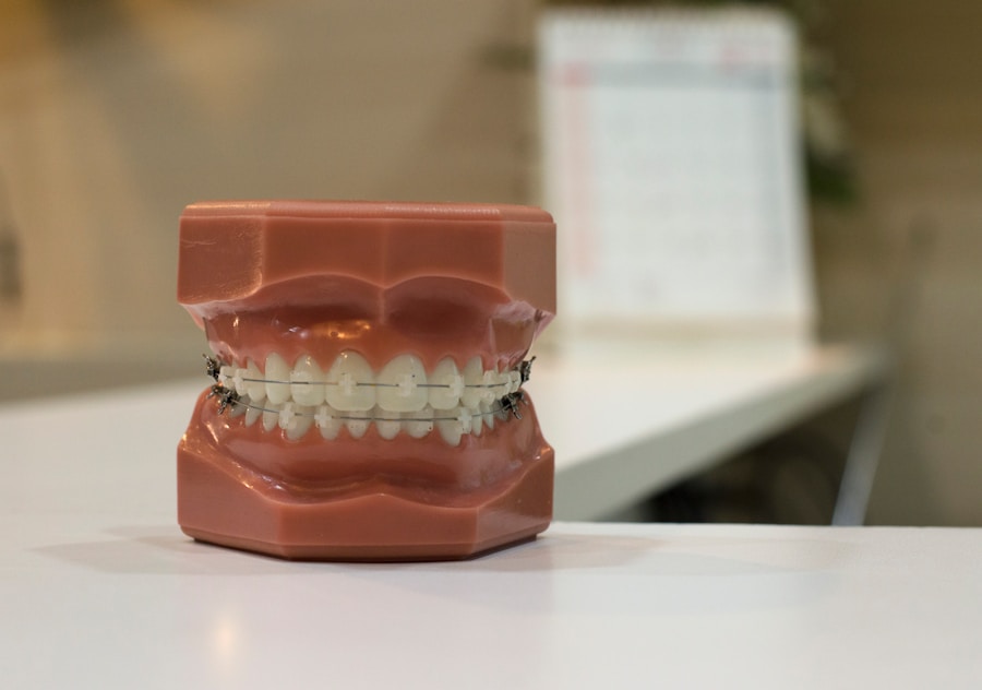 Photo "tooth decay cavity"