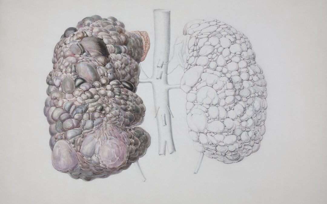 Photo Kidney diagram