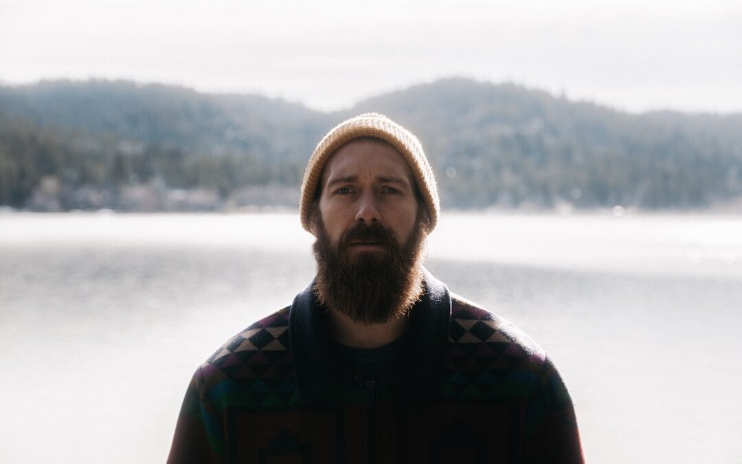 Photo Beard dandruff