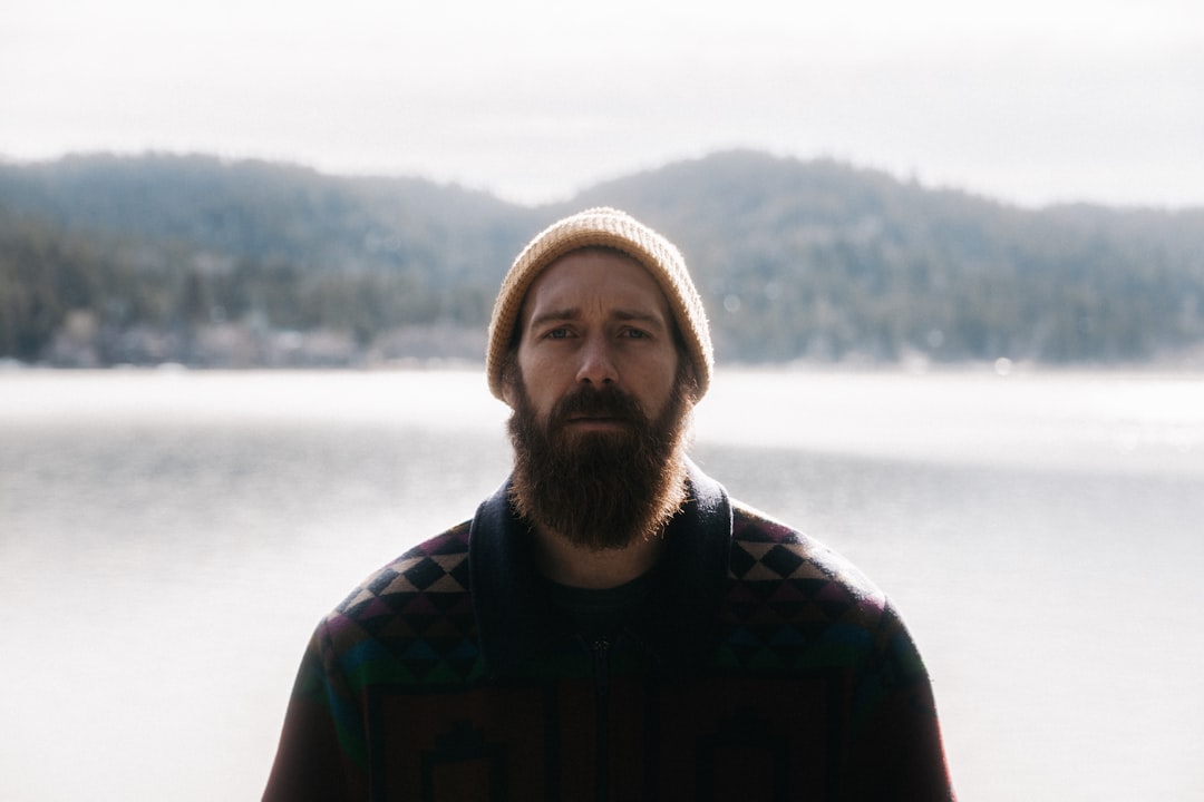 Photo Beard dandruff
