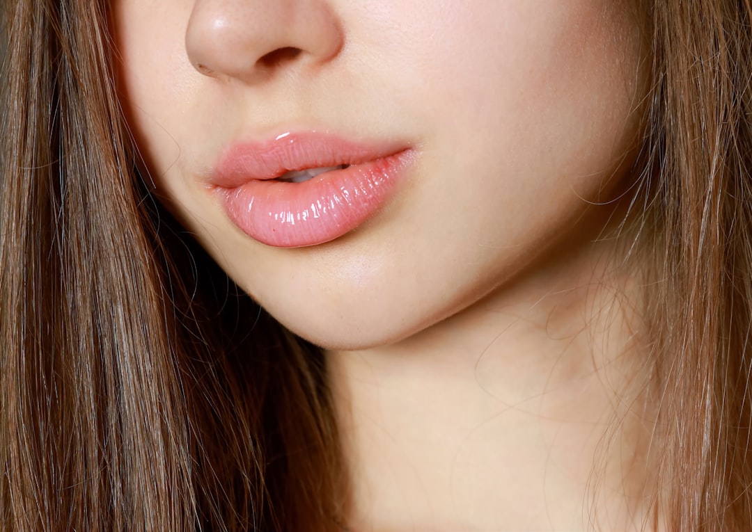 Photo Skin rash