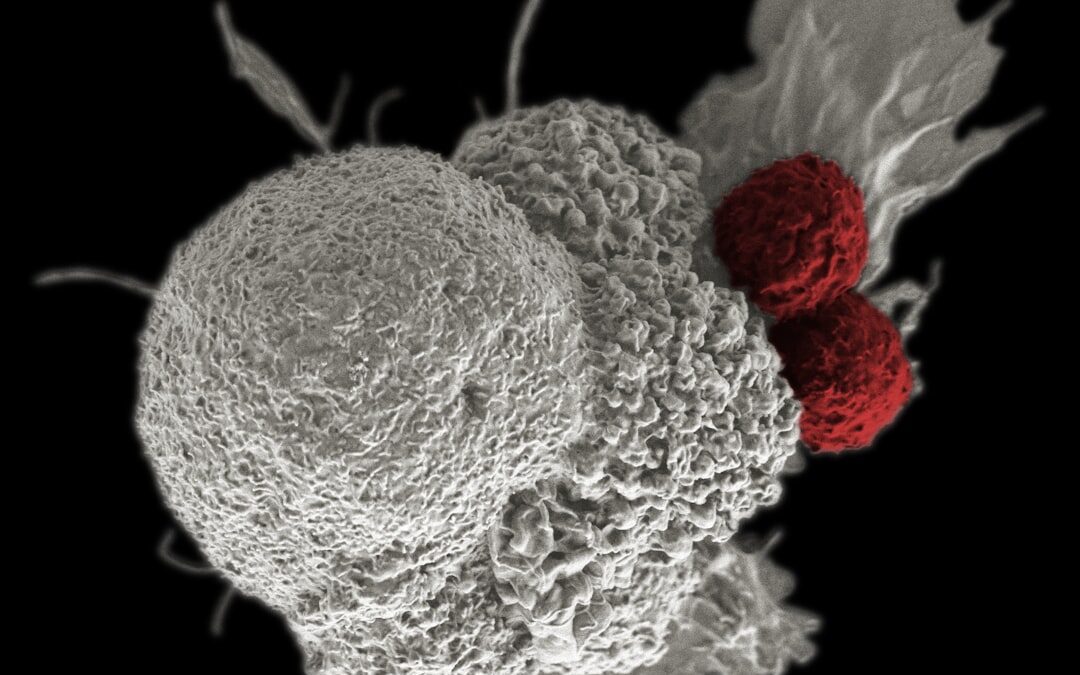 Photo Blood clot