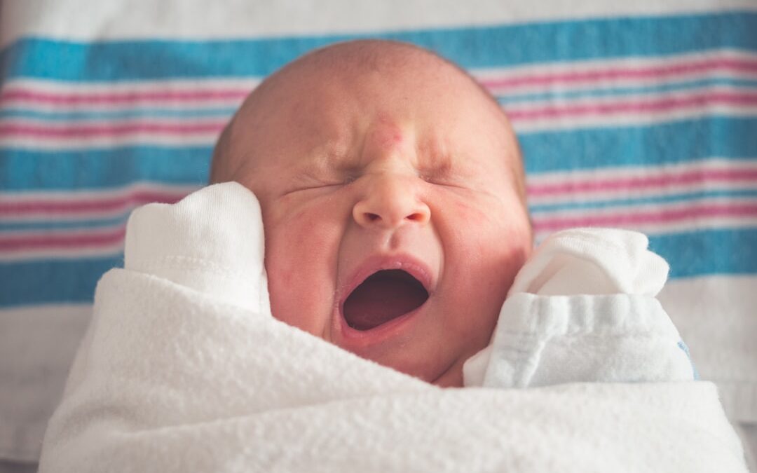 Photo Baby with umbilical hernia