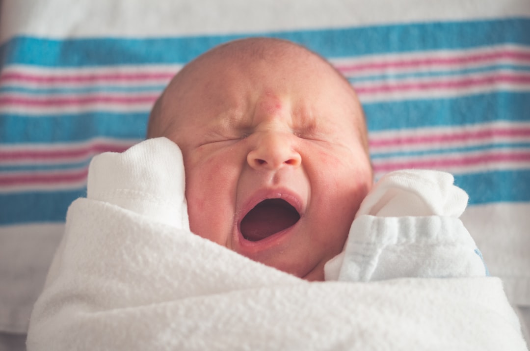 Photo Baby with umbilical hernia