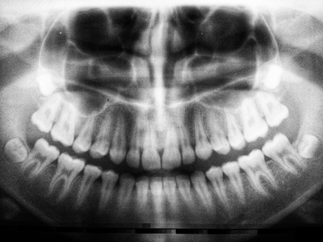 Photo CT scan