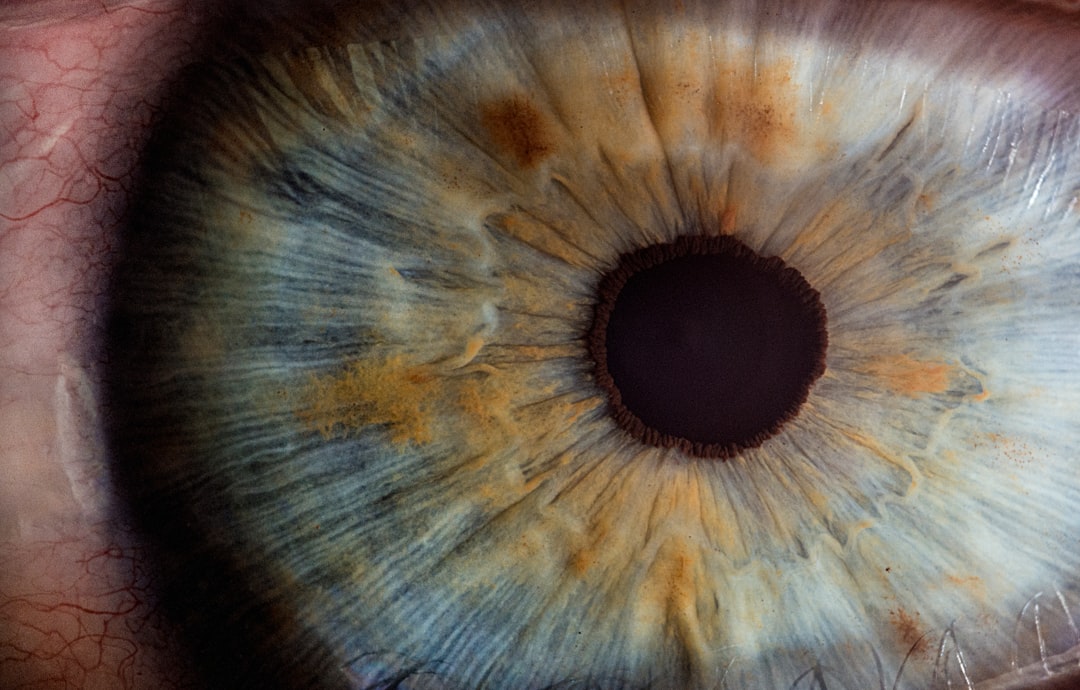 Photo Eye inflammation
