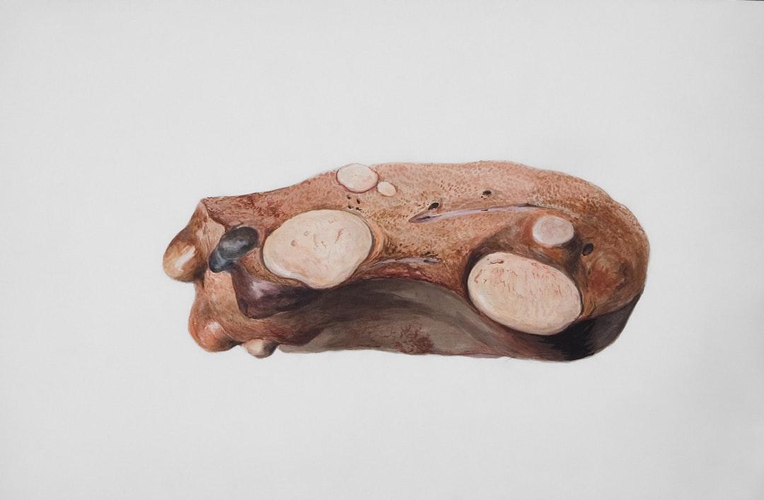 Photo Liver fluke