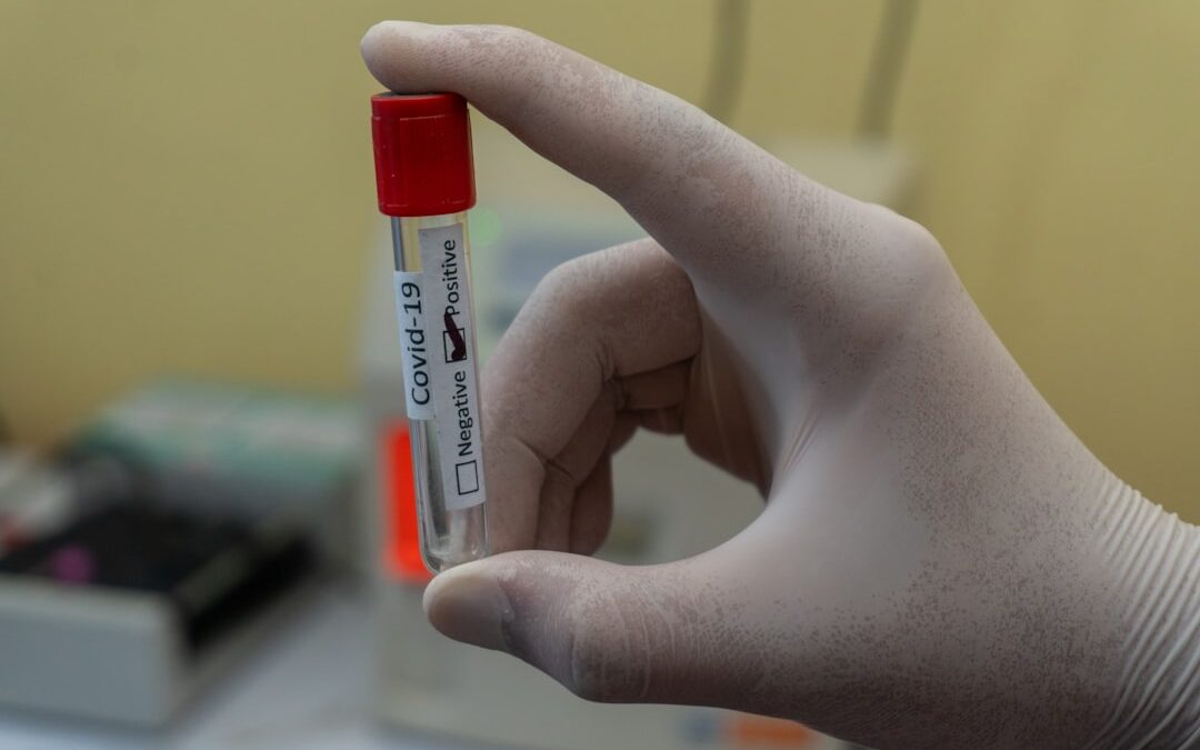 Photo Blood sugar