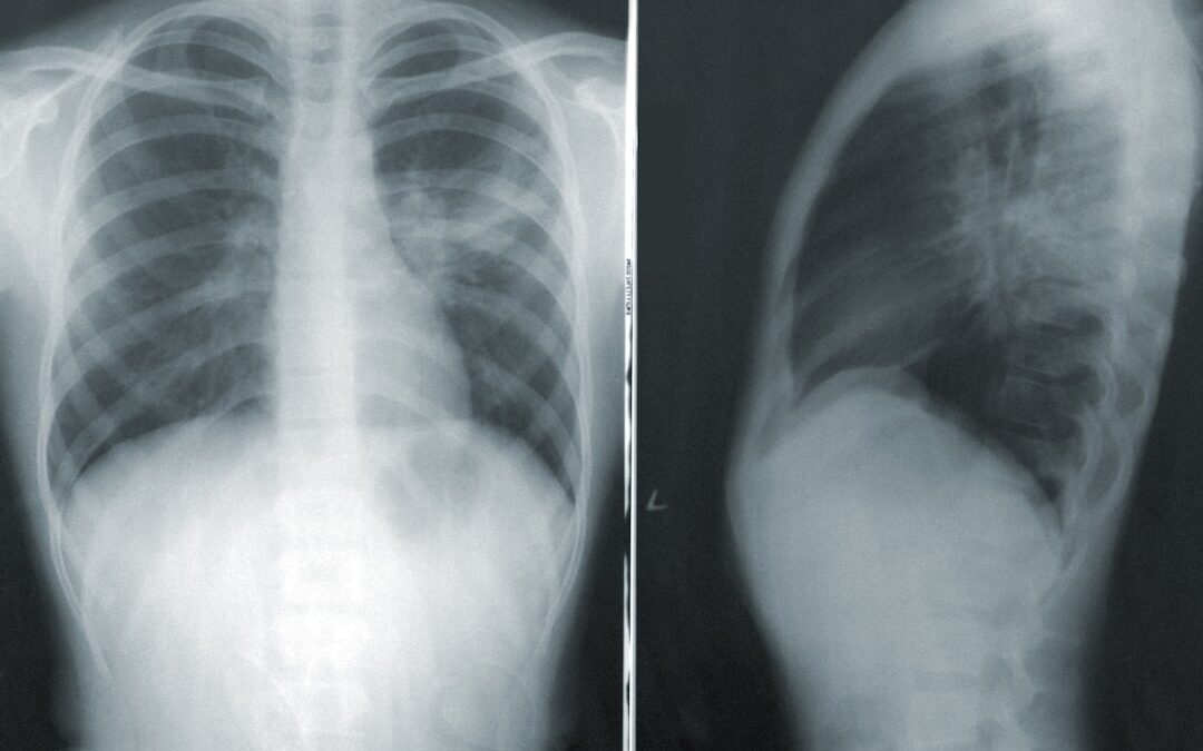 Photo MRI scan