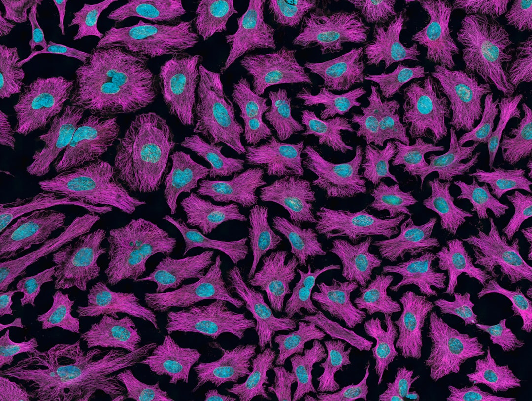 Photo Liver cancer