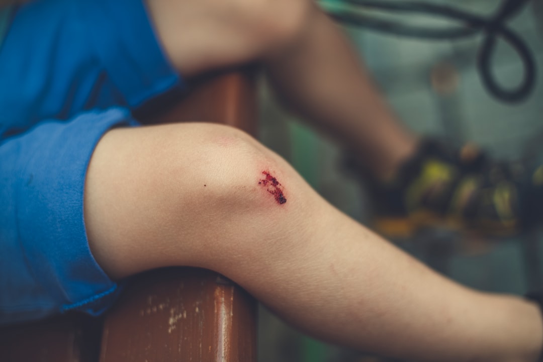 Photo Skin lesion