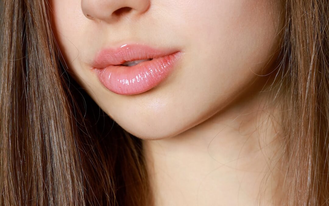 Photo Skin rash