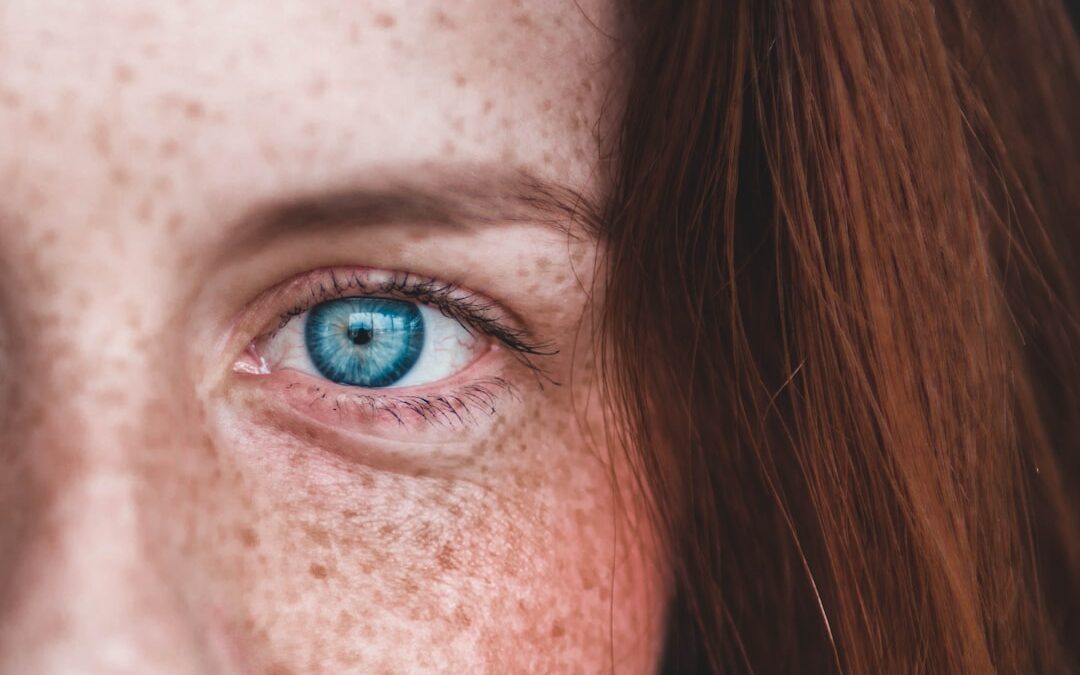 Photo Skin cream