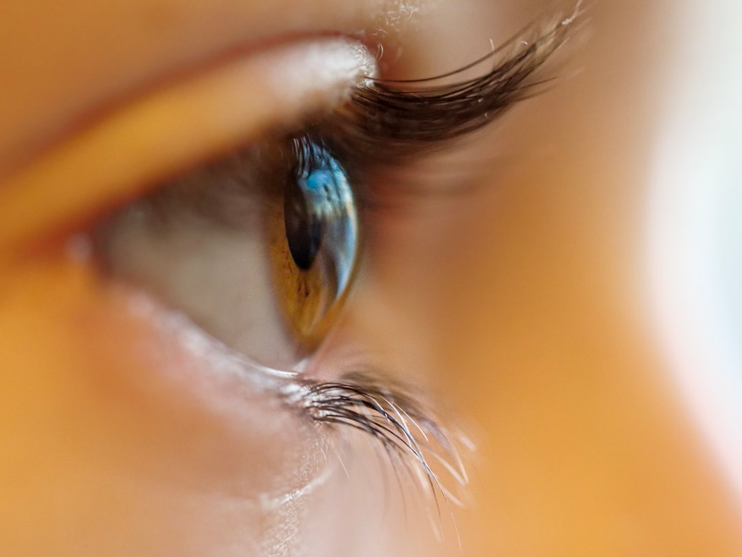 Photo Contact lenses