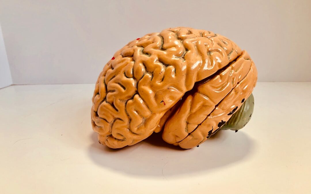Photo Brain scan