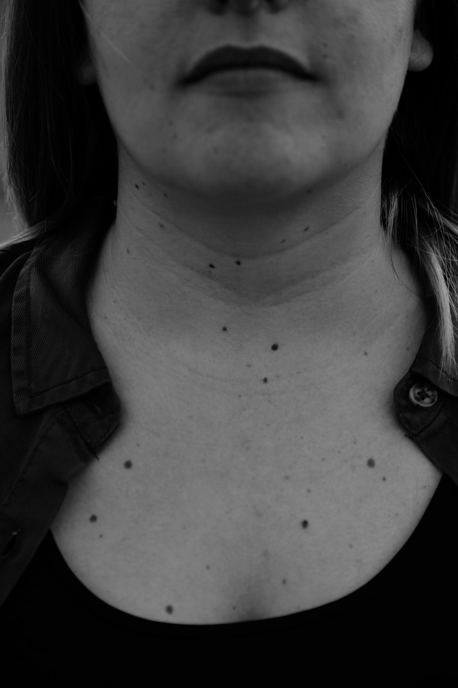 Photo Fordyce spots