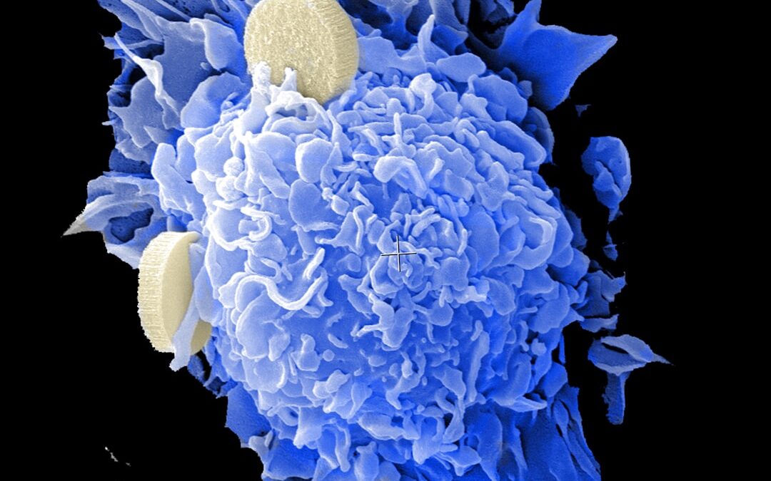 Photo Cancer cells