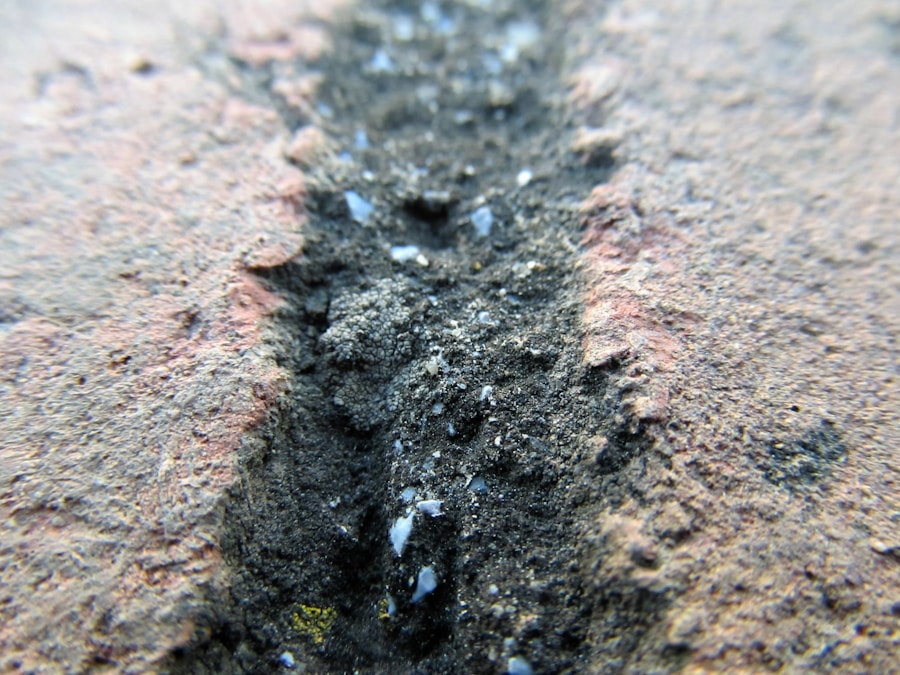 Photo "removal of fordyce spots"