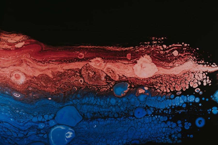 Photo "treatment of fordyce spots"