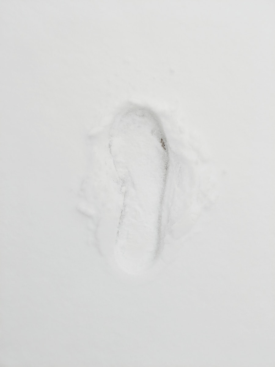 Photo Fordyce spots ointment