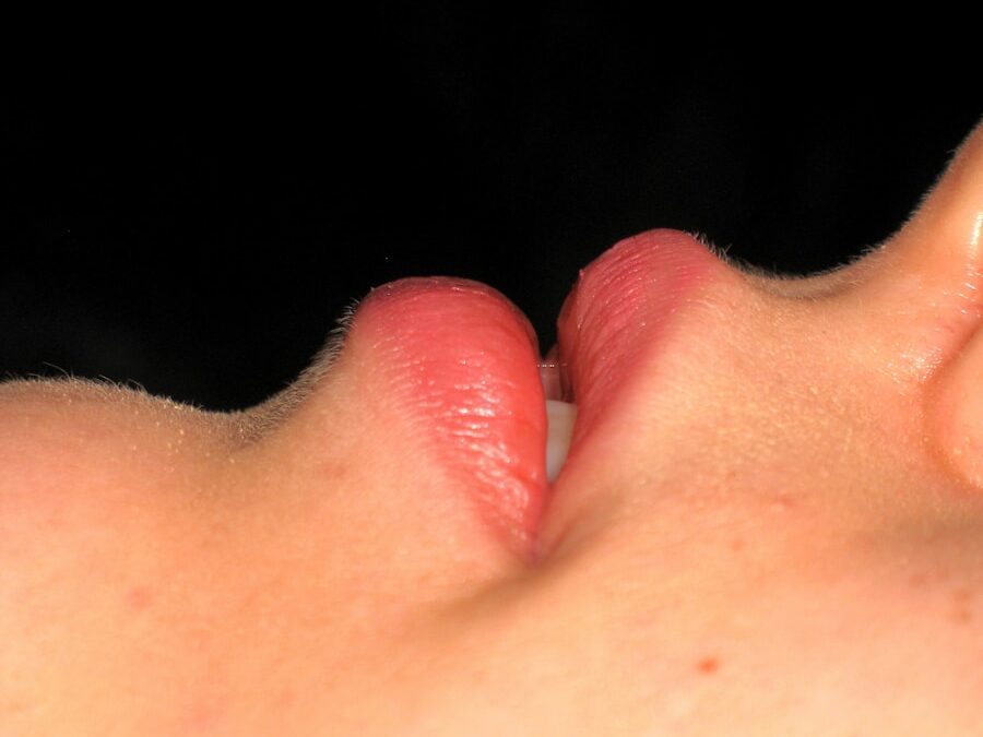 Photo "swelling of the salivary gland pictures"