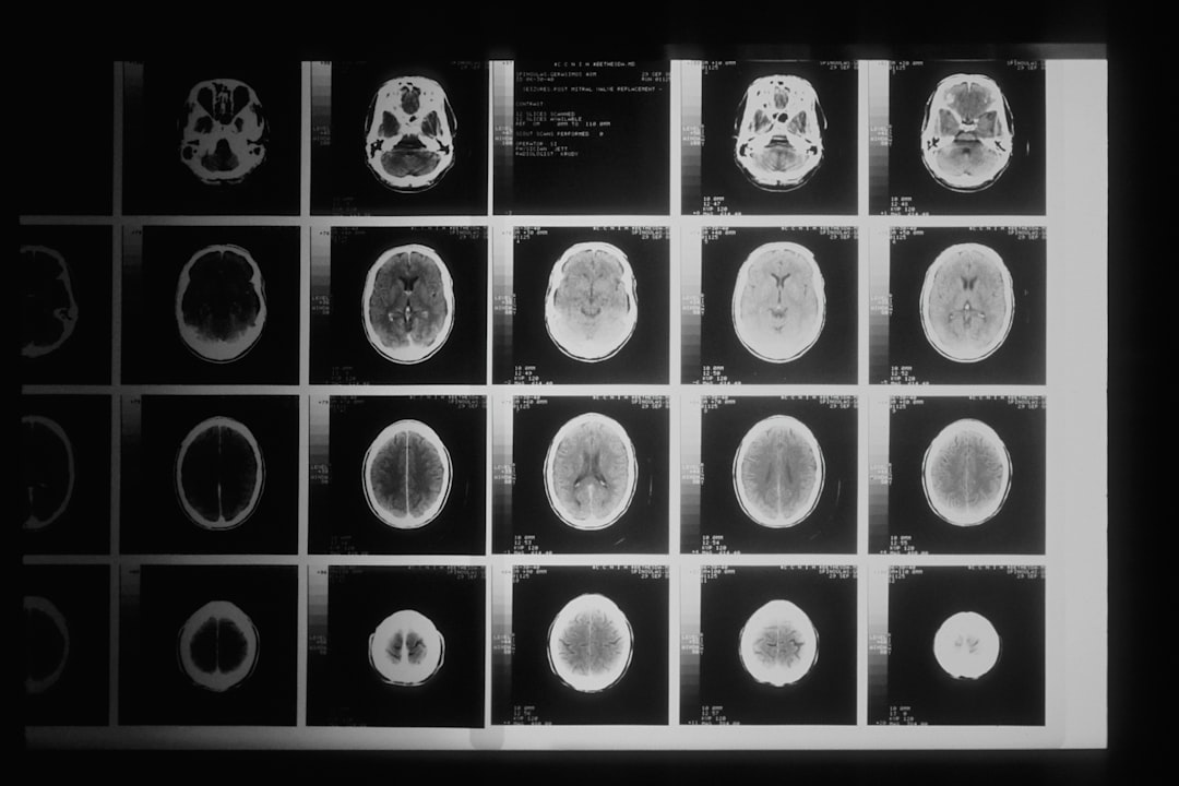 Photo CT scan