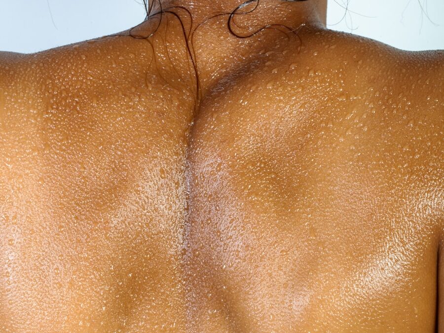 Photo "treatment of swollen sweat glands"