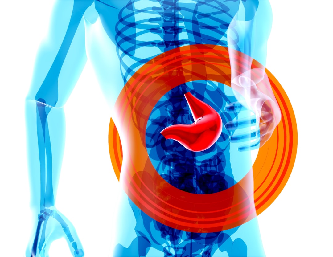 Photo Stomach ulcer