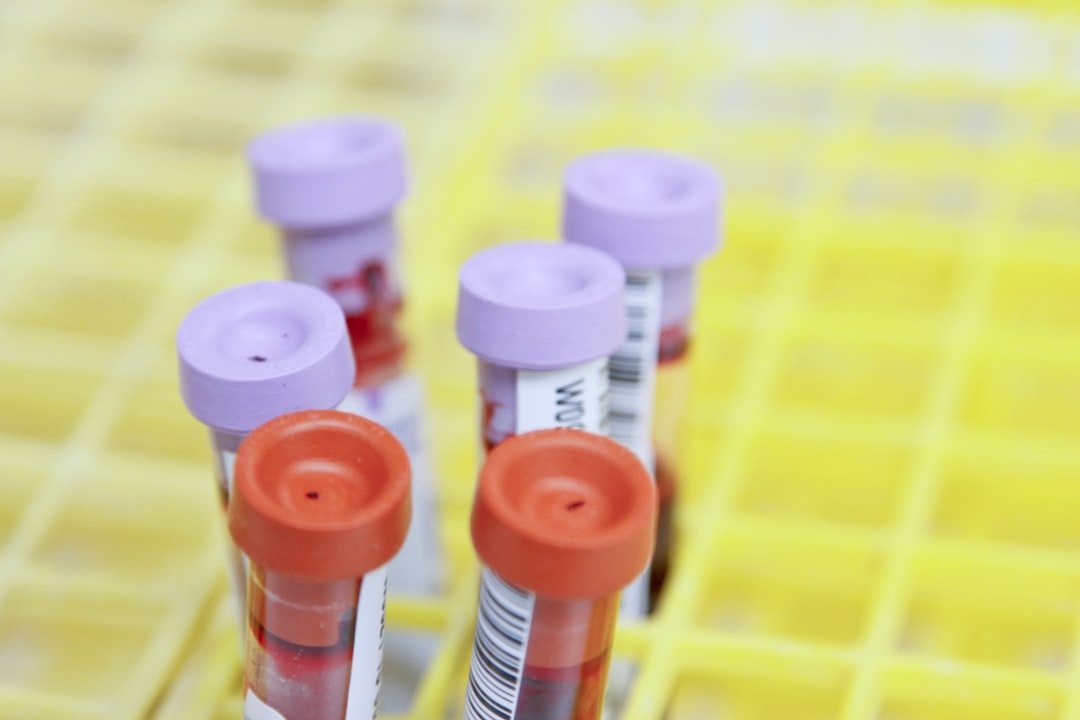 Photo Blood test