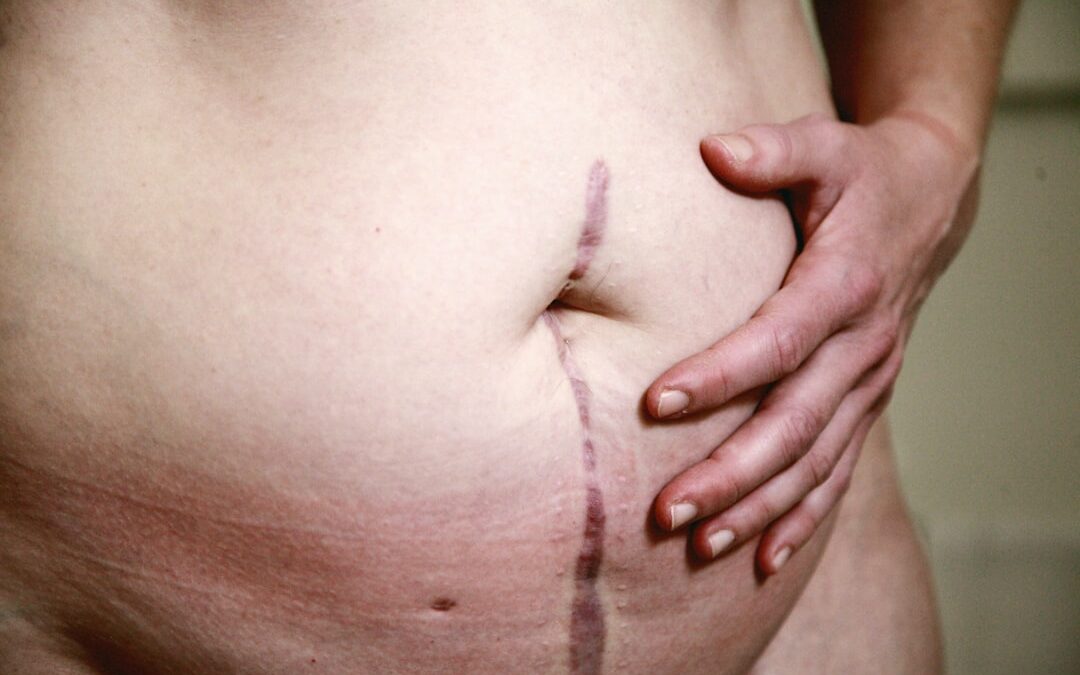 Photo Stomach inflammation