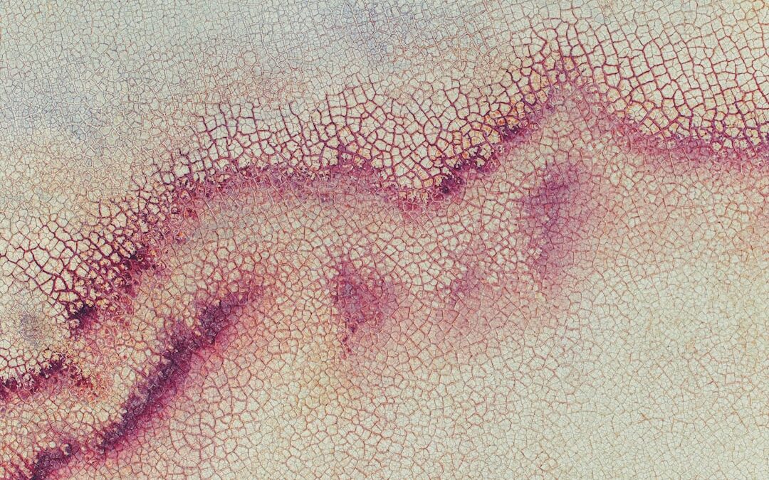 Photo Wound diagram