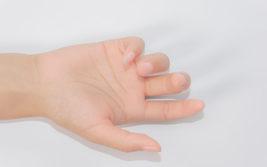 Photo Swollen finger