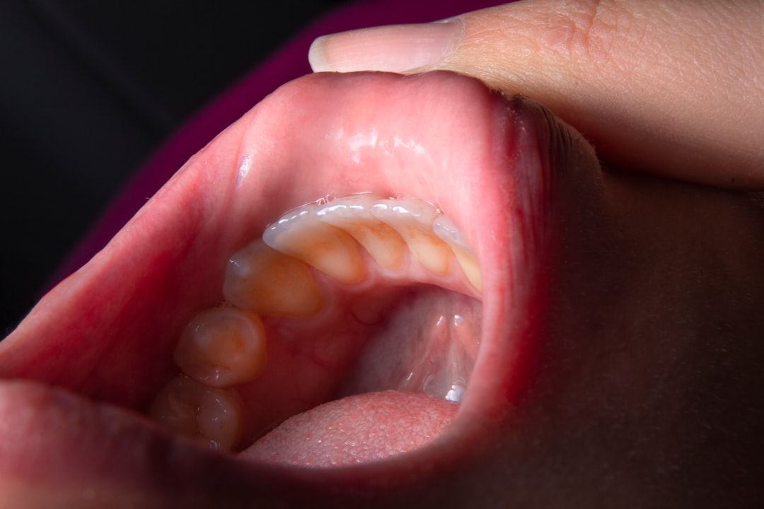 Photo Sore throat