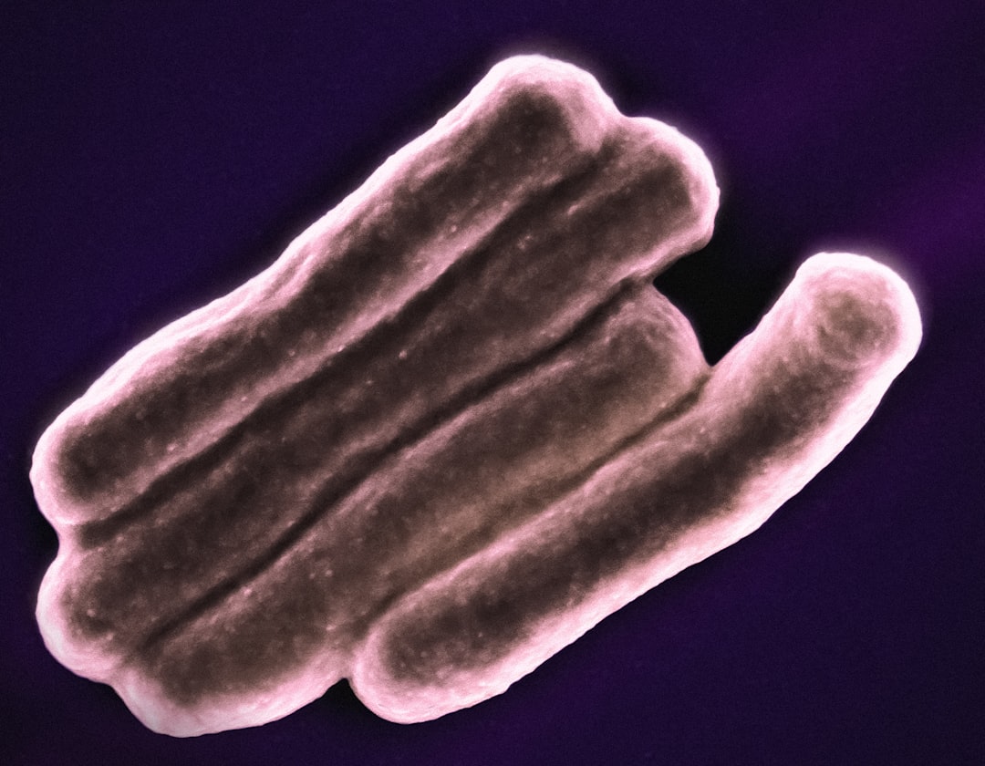 Photo Bacterial infection