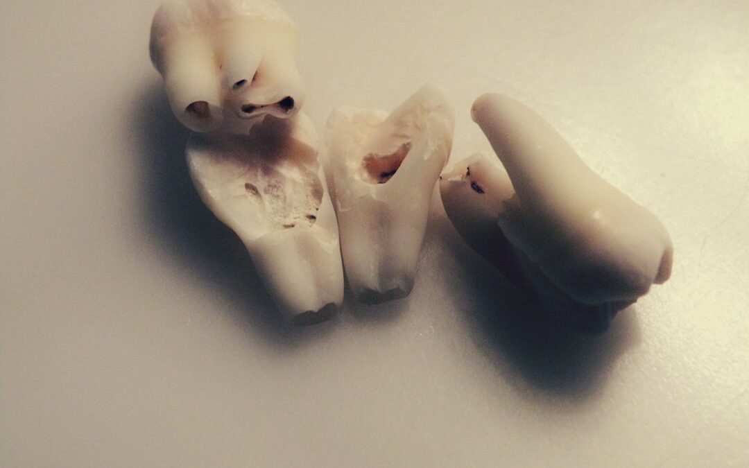 Photo Dental X-ray