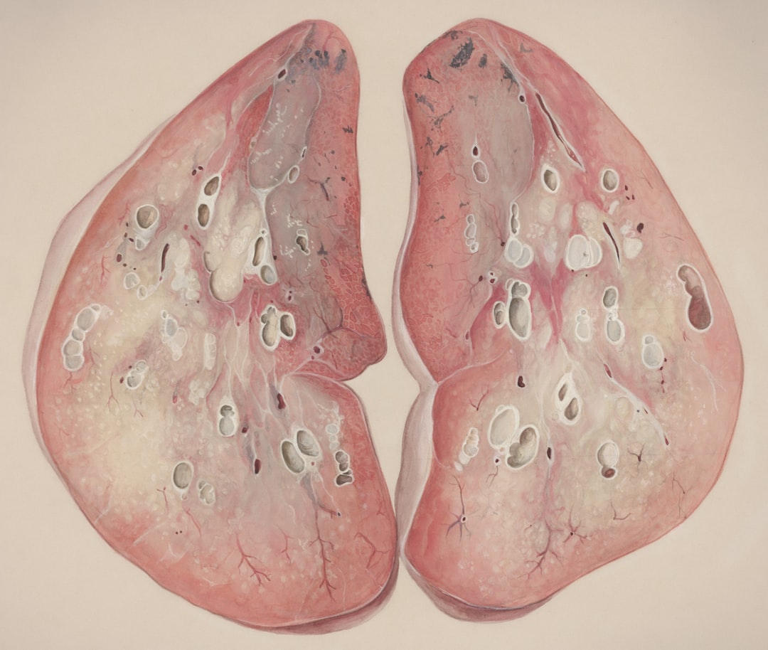 Photo Inflammation in lungs
