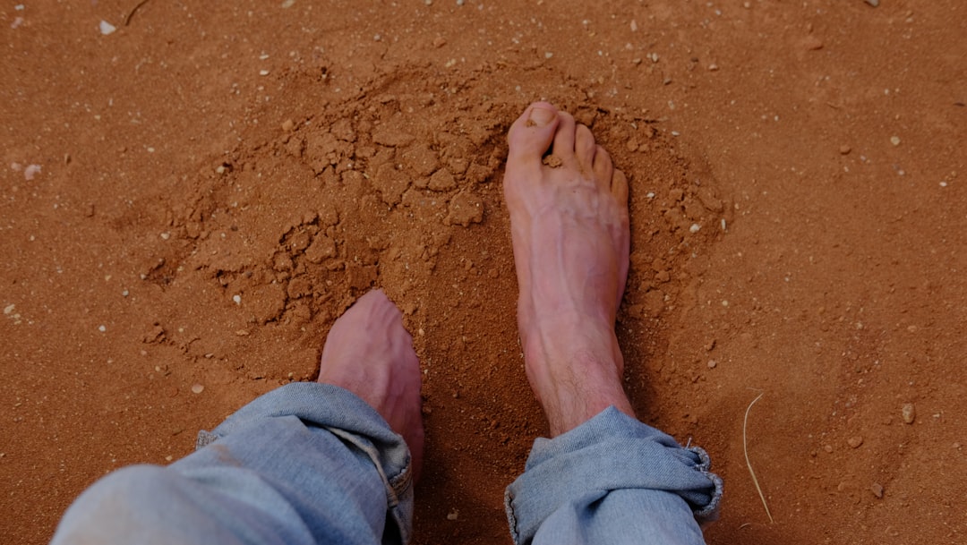 Photo Infected foot