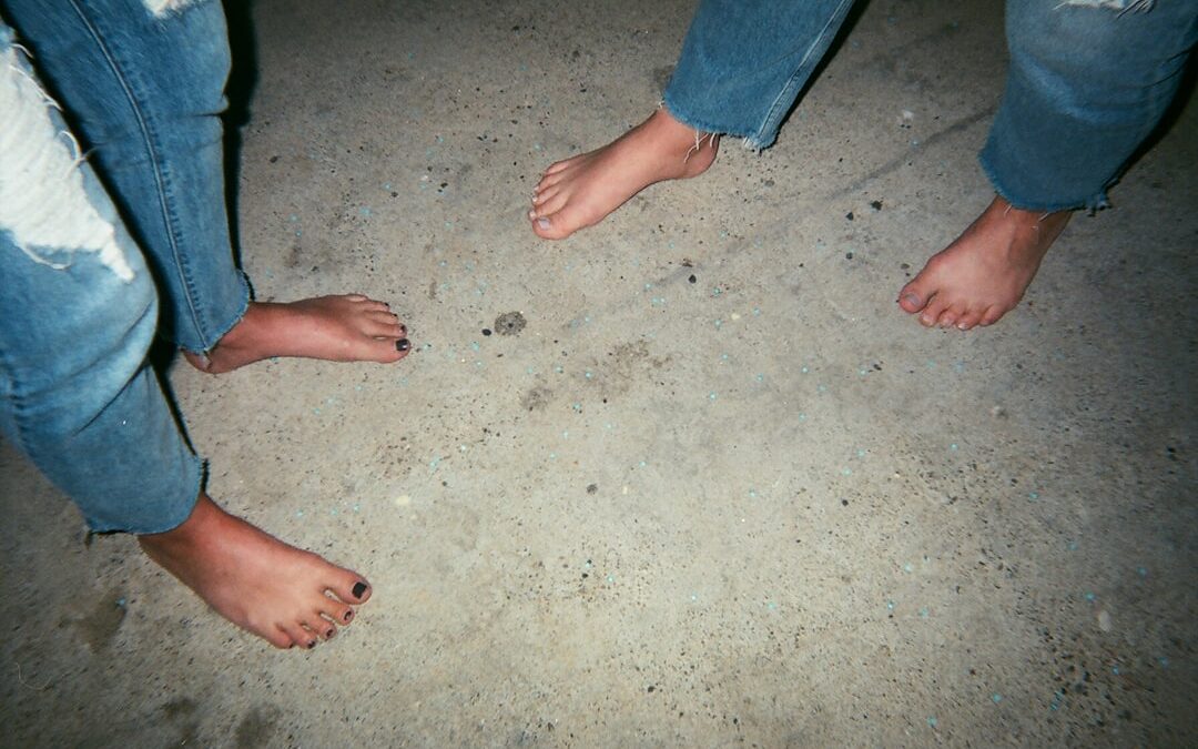 Photo Swollen foot