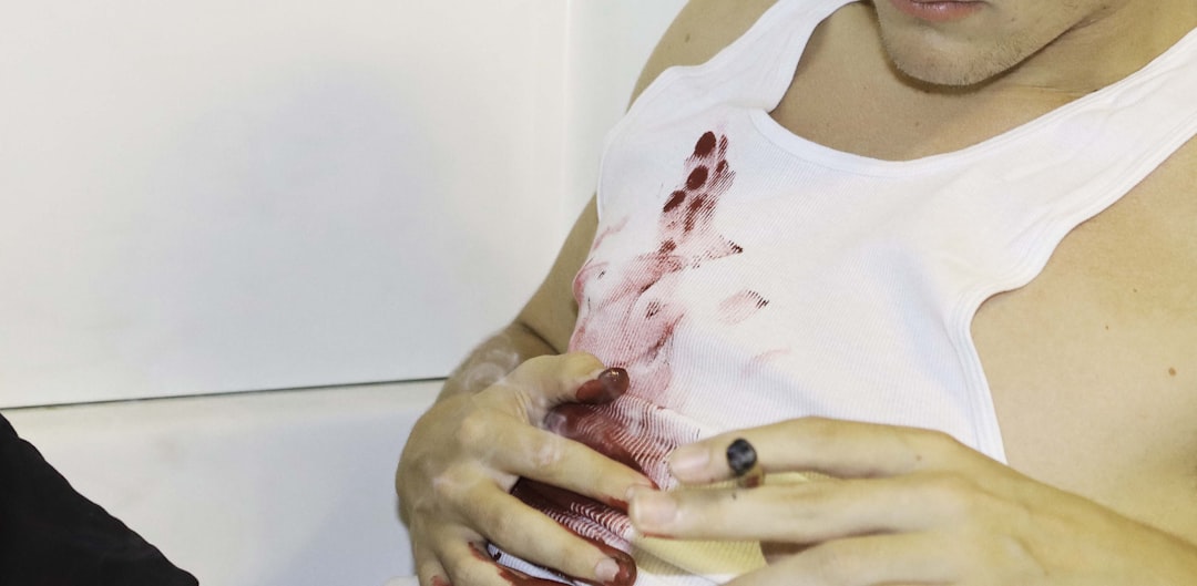 Photo Nosebleed