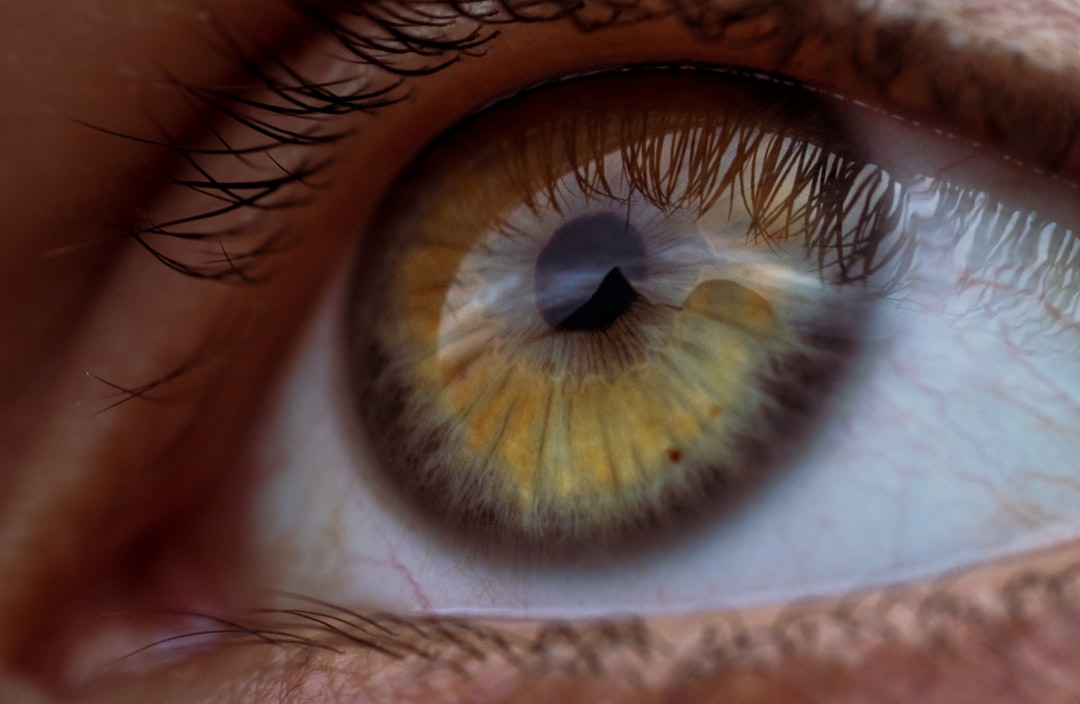 Photo Eye strain