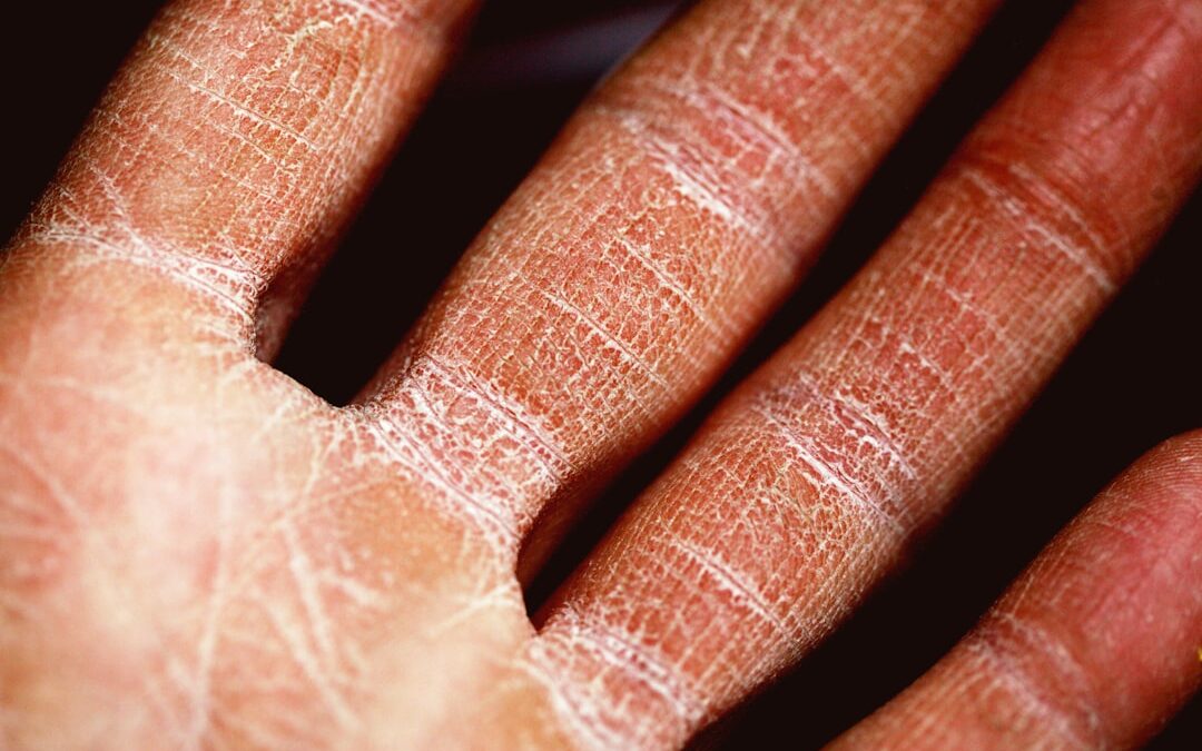 Photo itchy skin