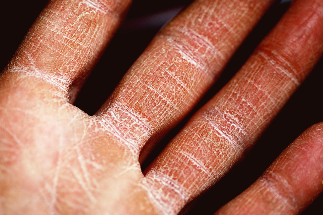 Photo itchy skin